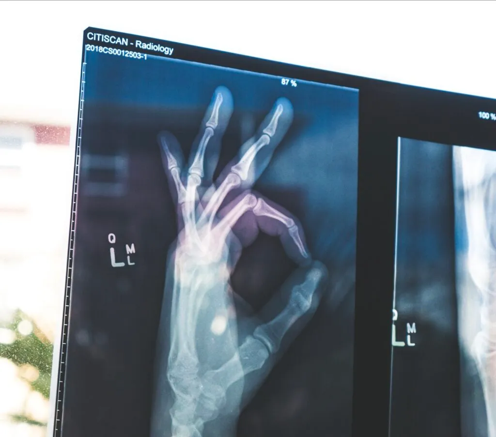 ¿Cómo percibimos nuestra salud los españoles?